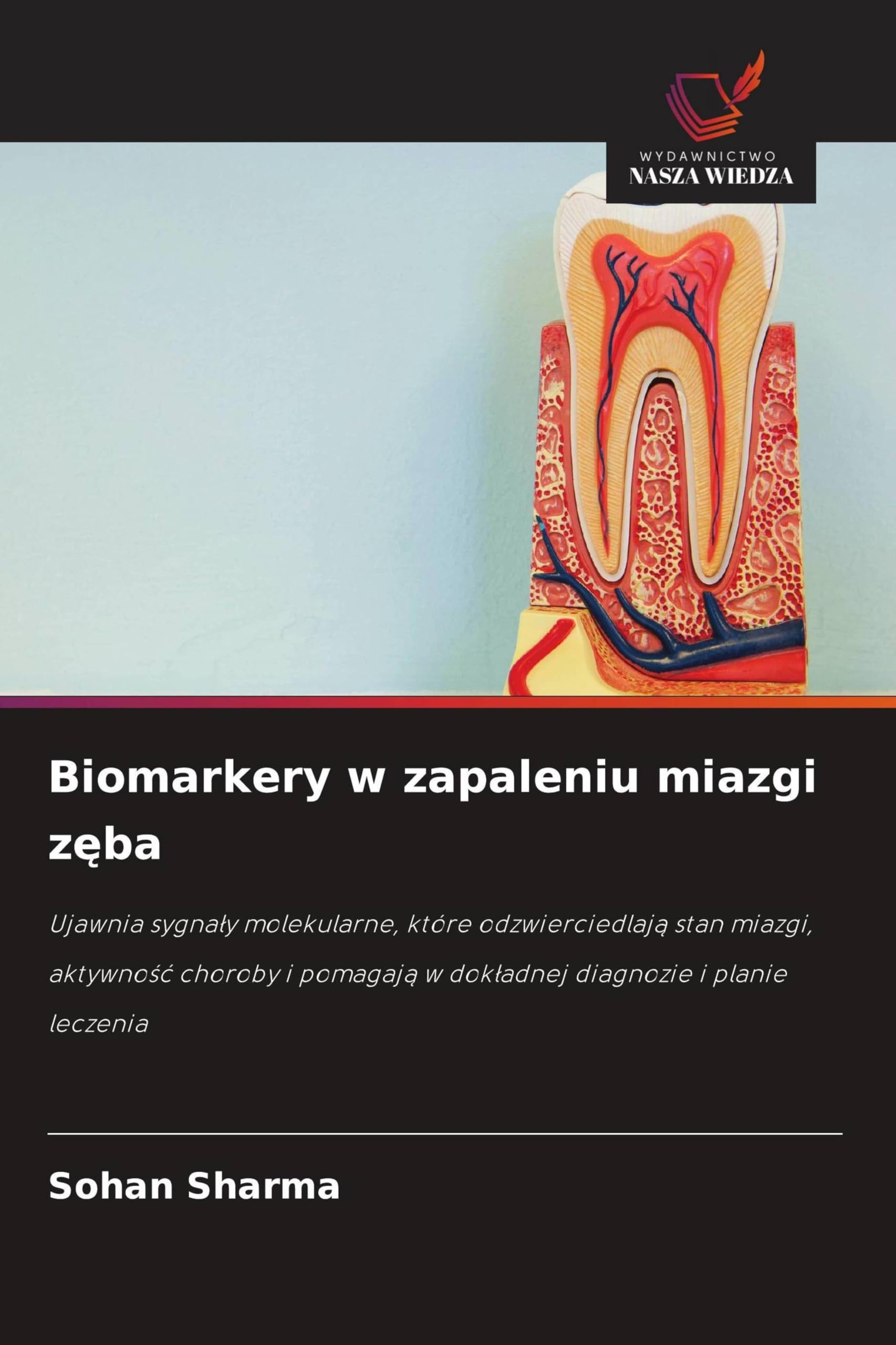 Biomarkery w zapaleniu miazgi z¿ba Books