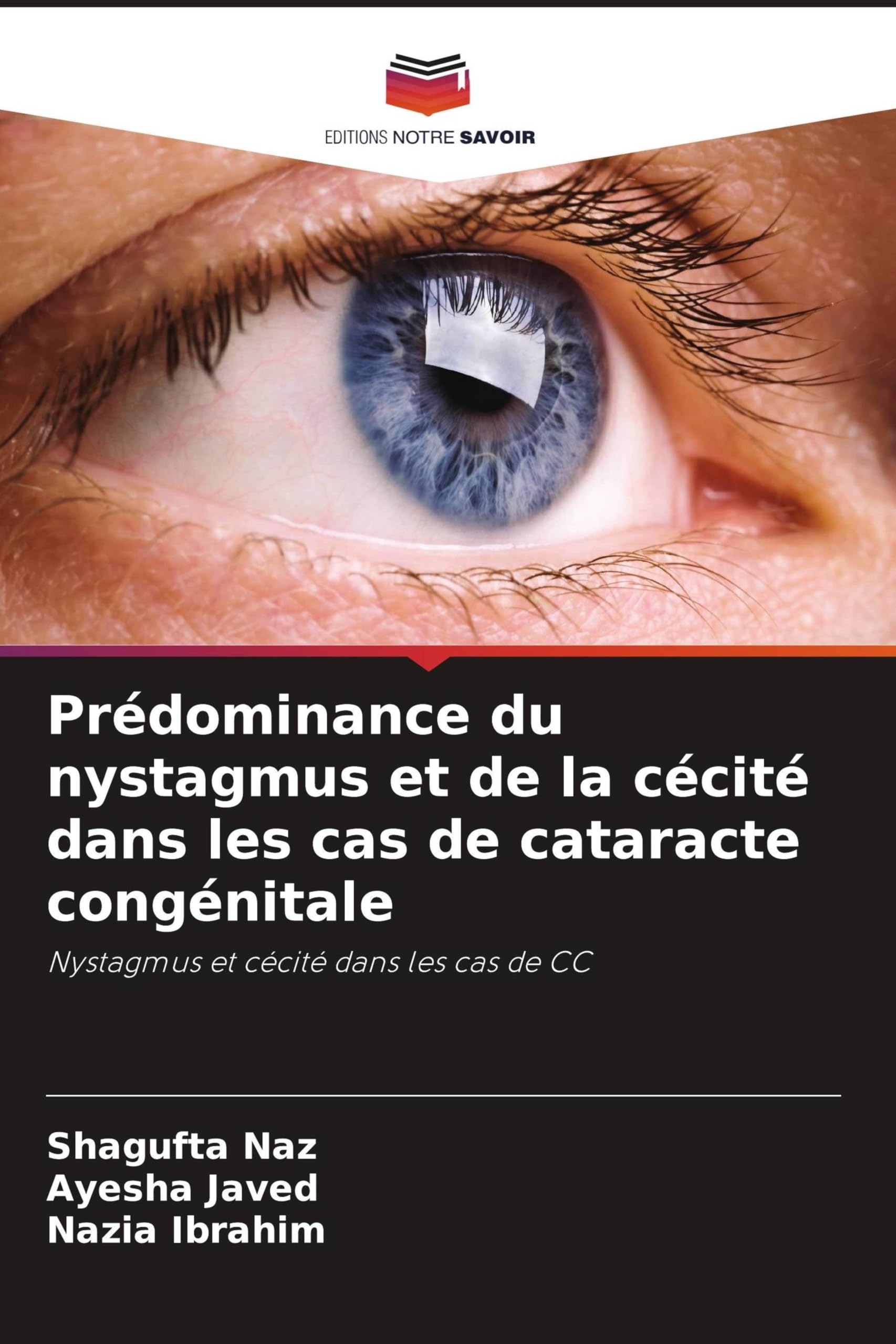 Prédominance du nystagmus et de la cécité dans les cas de cataracte congénitale Natural Sciences