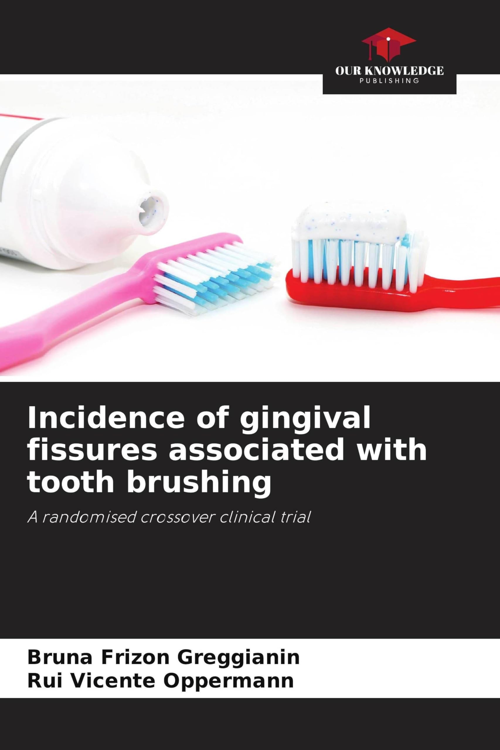 Incidence of gingival fissures associated with tooth brushing Medicine