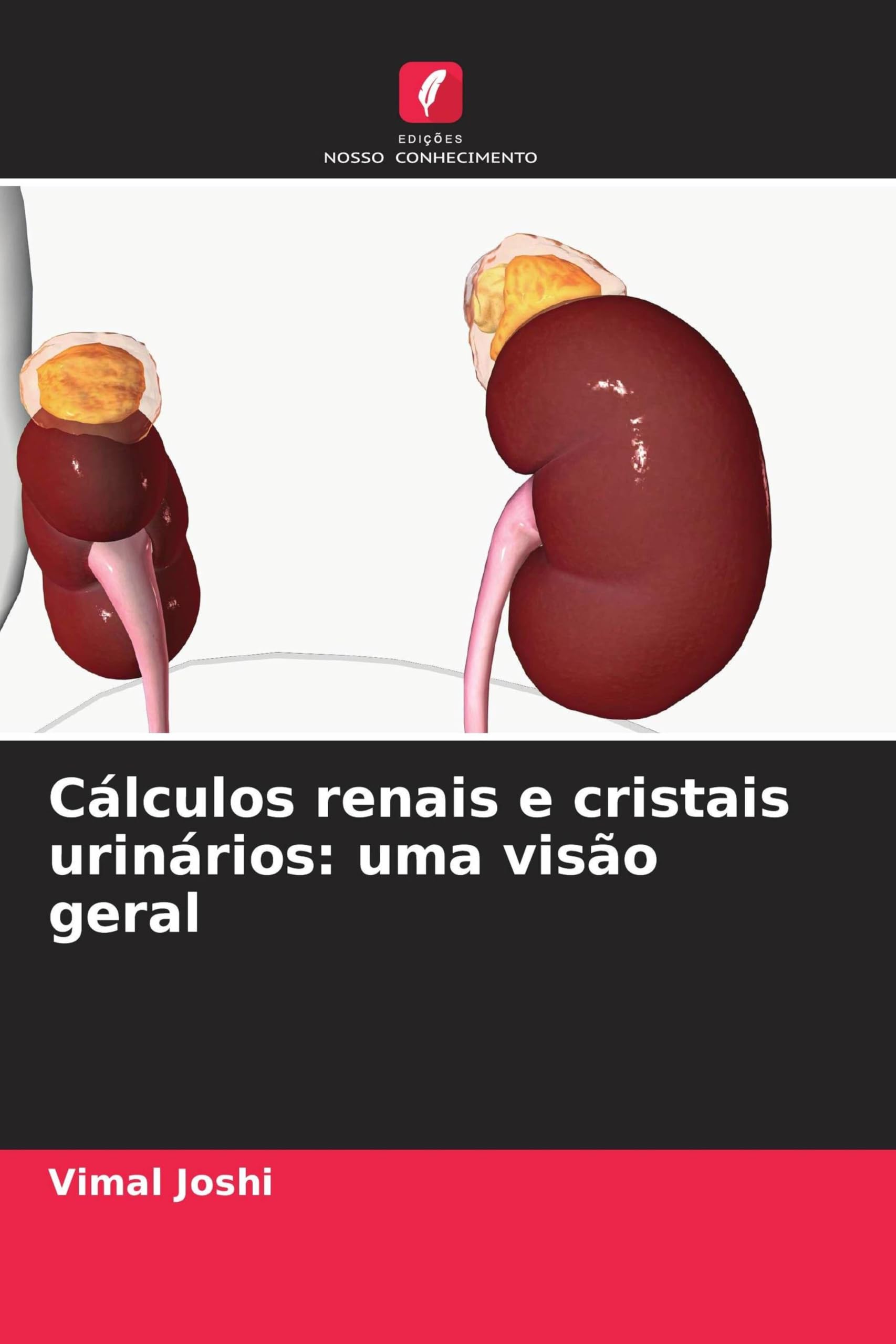 Cálculos renais e cristais urinários: uma visão geral Natural Sciences
