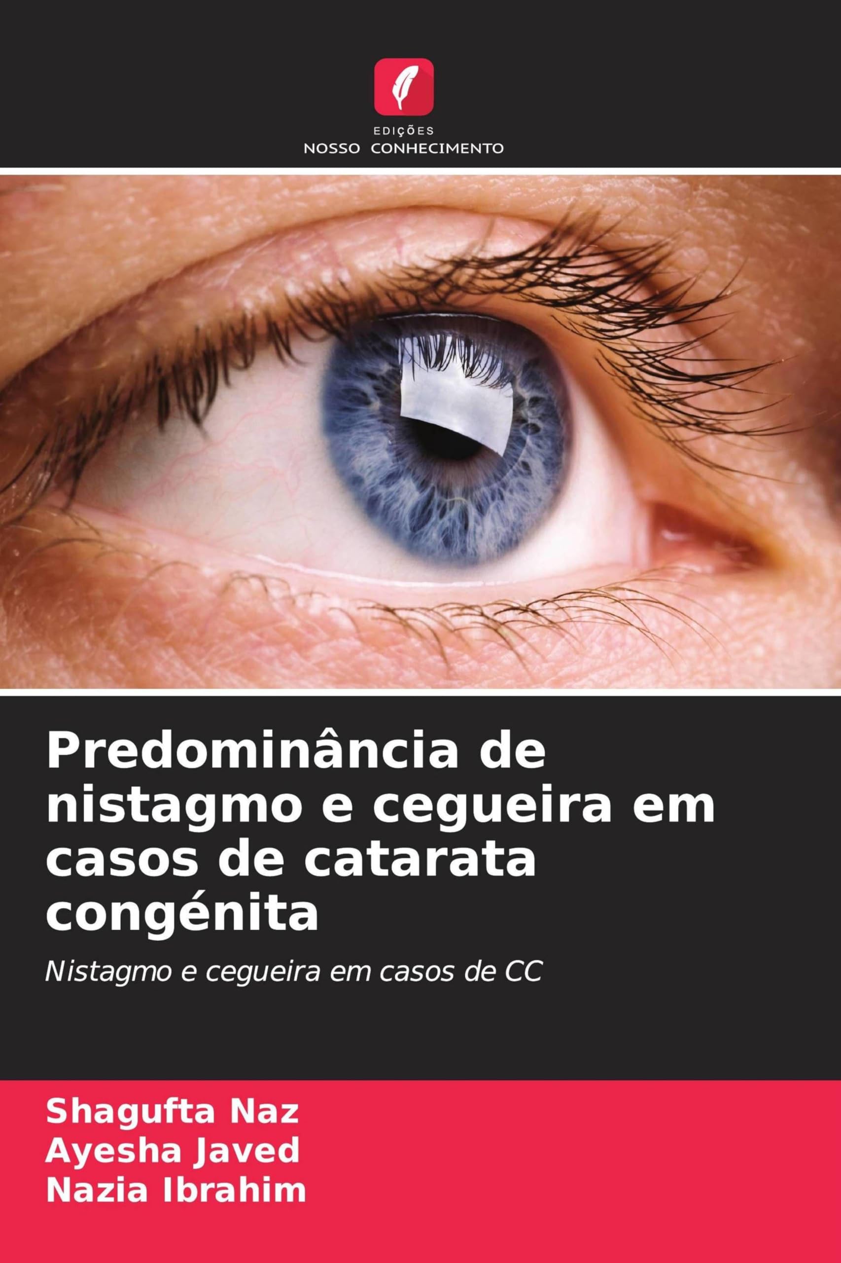 Predominância de nistagmo e cegueira em casos de catarata congénita Natural Sciences