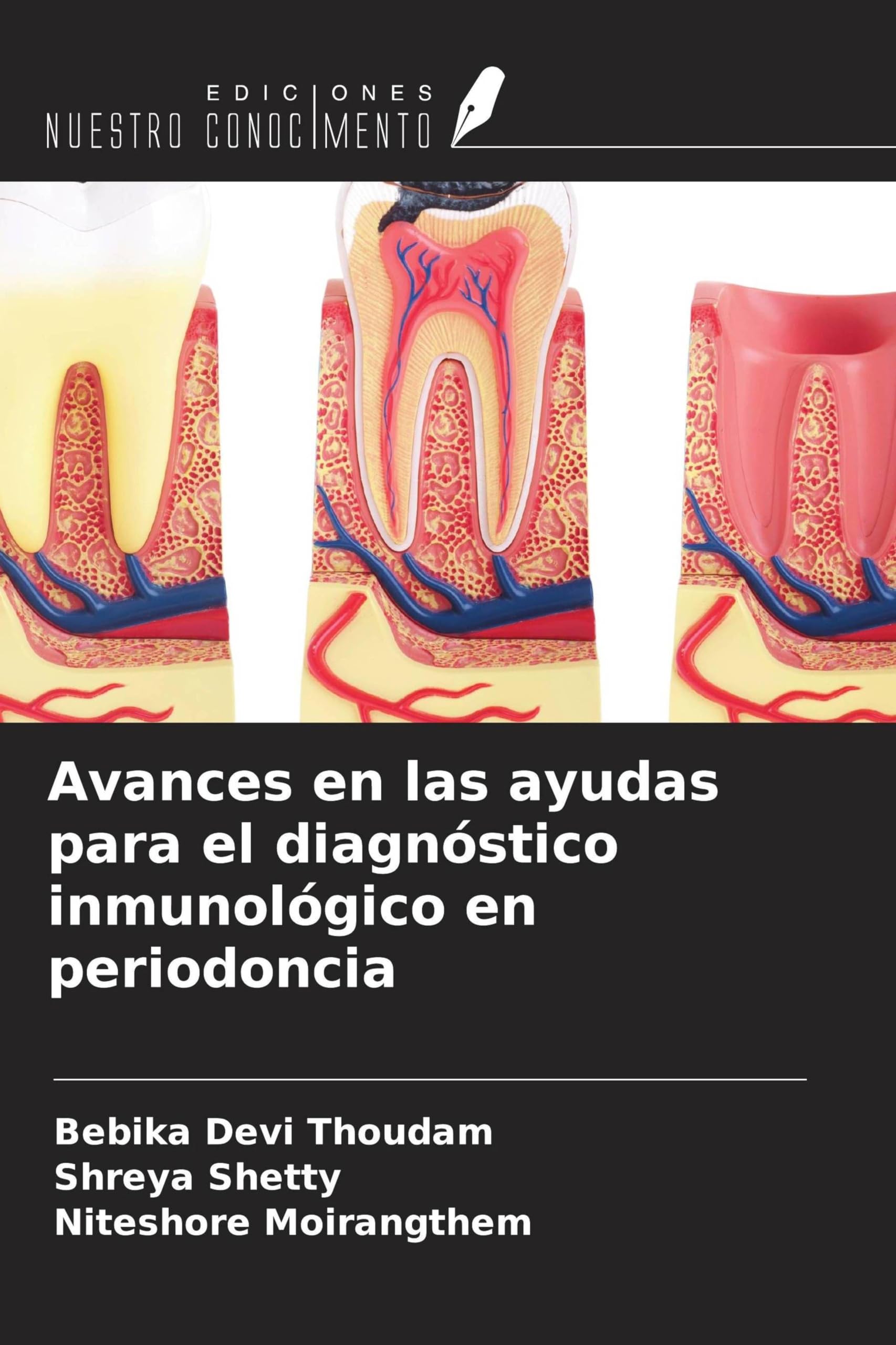 Avances en las ayudas para el diagnóstico inmunológico en periodoncia Medicine
