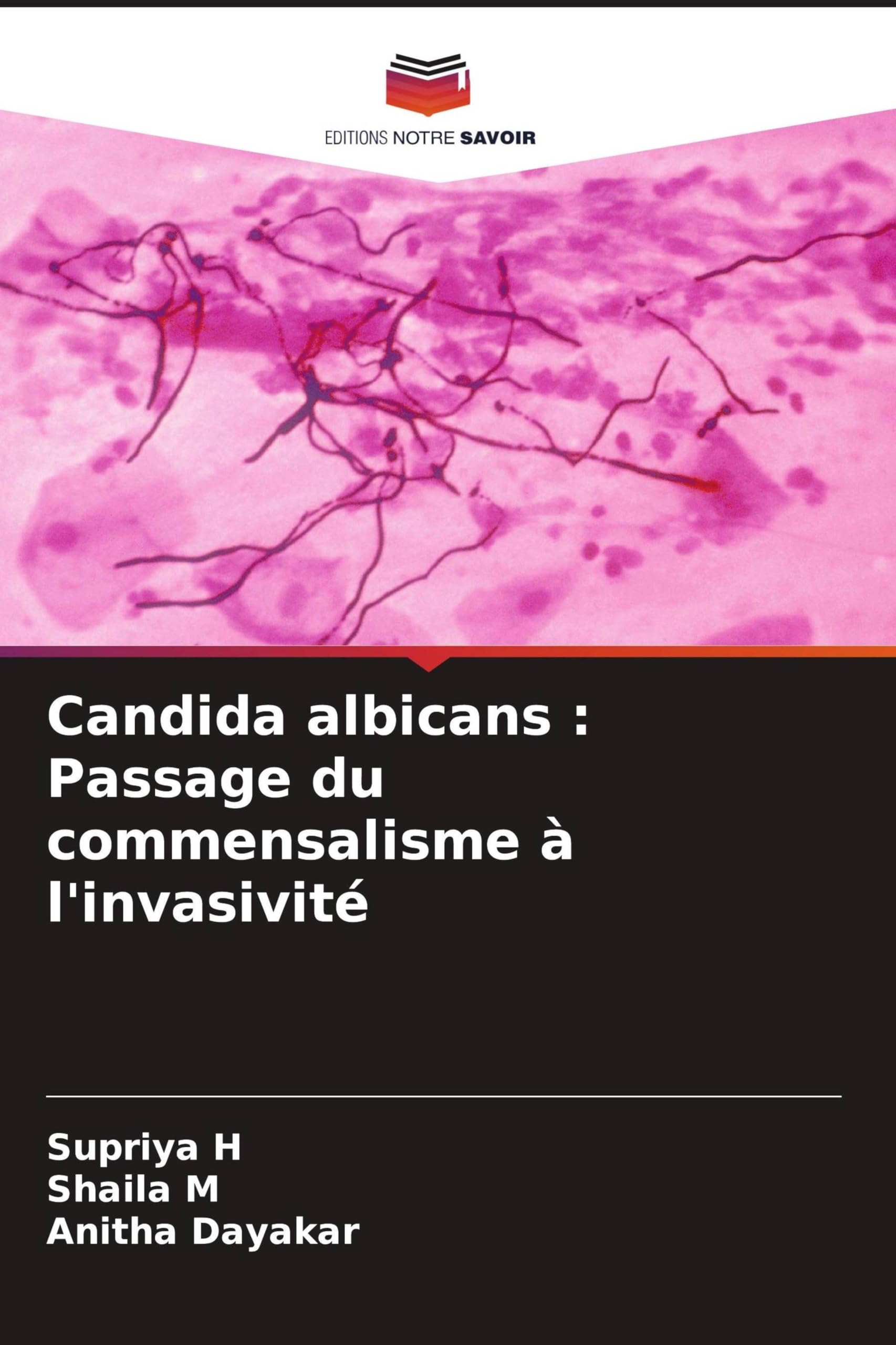 Candida albicans : Passage du commensalisme à l'invasivité: DE Books