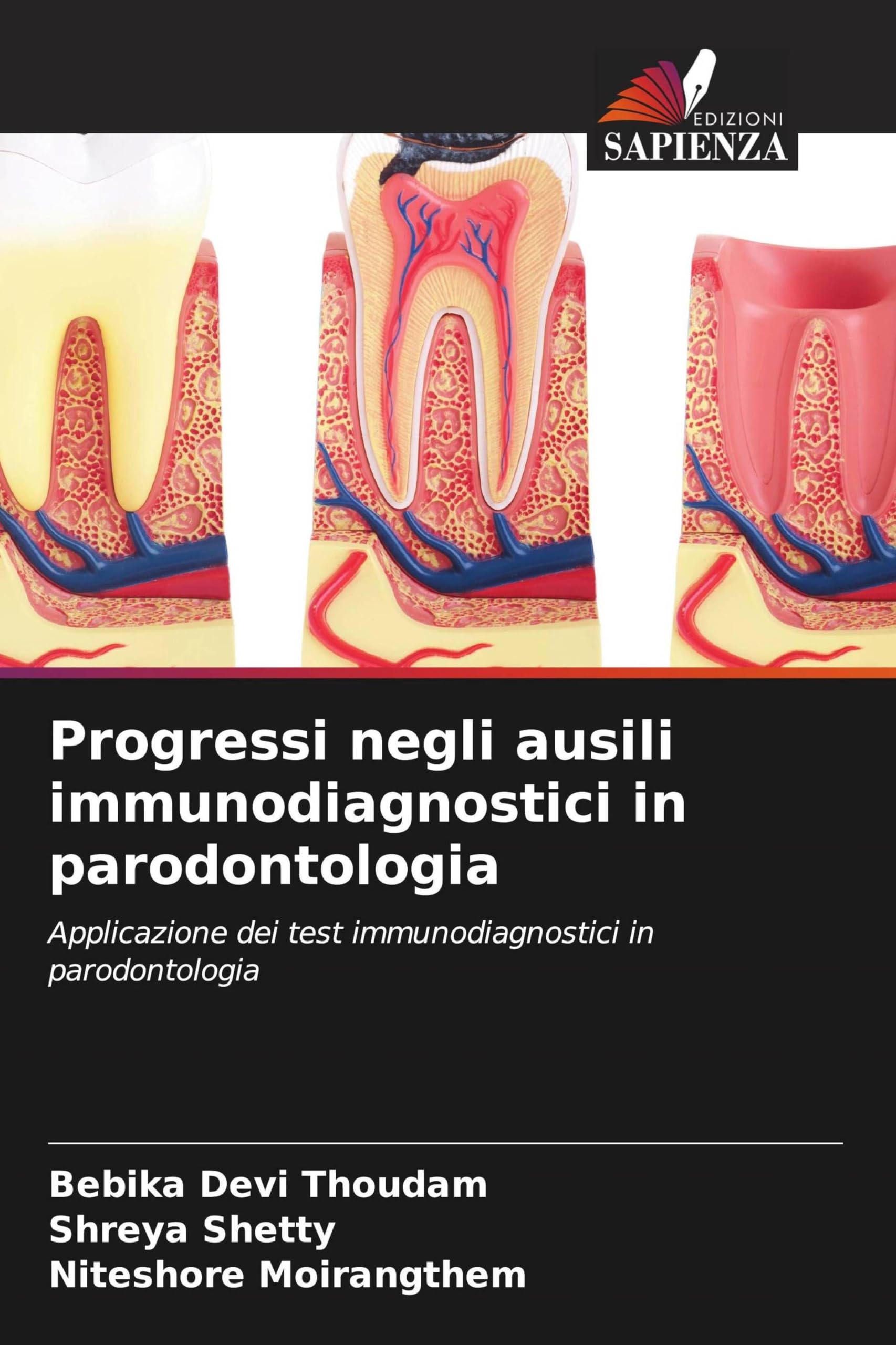 Progressi negli ausili immunodiagnostici in parodontologia Medicine