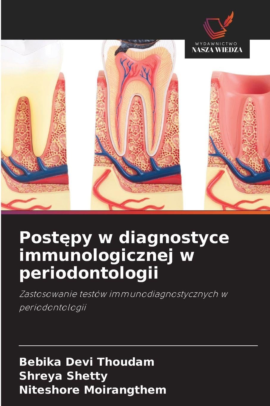 Post¿py w diagnostyce immunologicznej w periodontologii Medicine