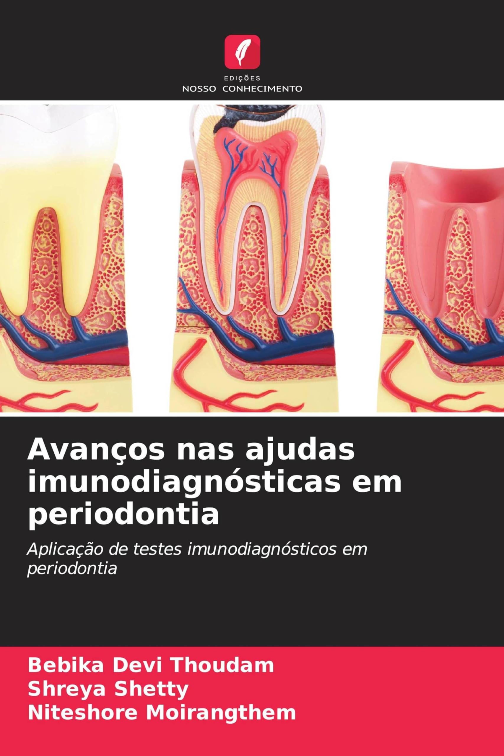 Avanços nas ajudas imunodiagnósticas em periodontia Medicine