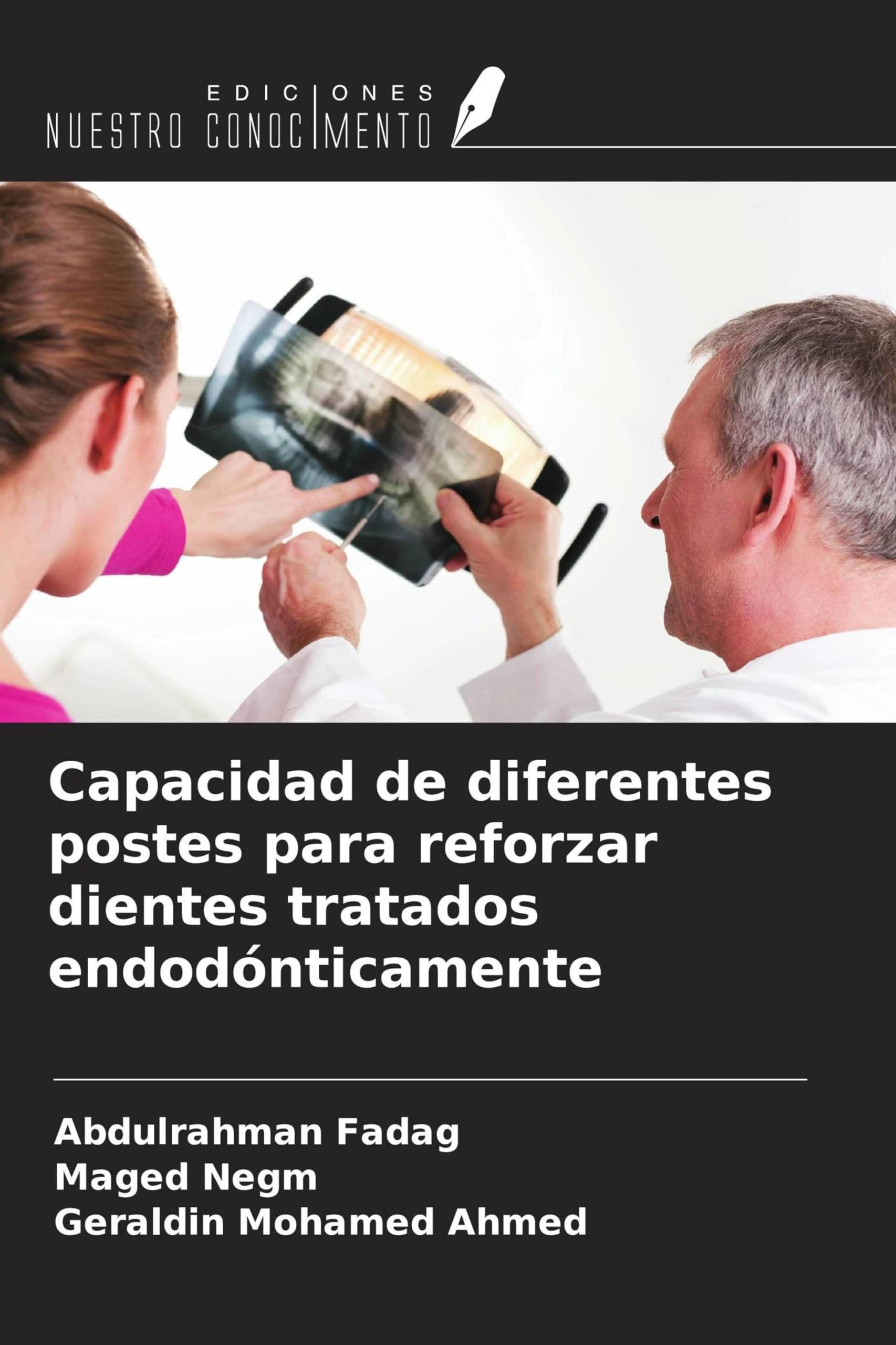 Capacidad de diferentes postes para reforzar dientes tratados endodónticamente Medicine