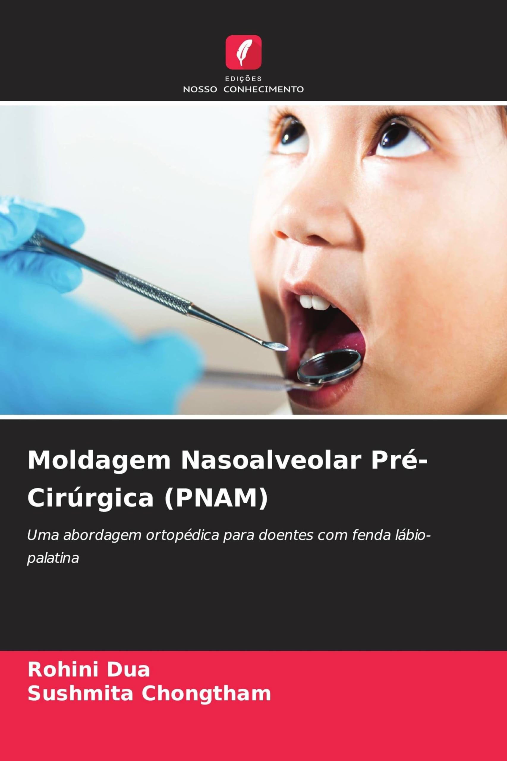 Moldagem Nasoalveolar Pré-Cirúrgica (PNAM) Medicine