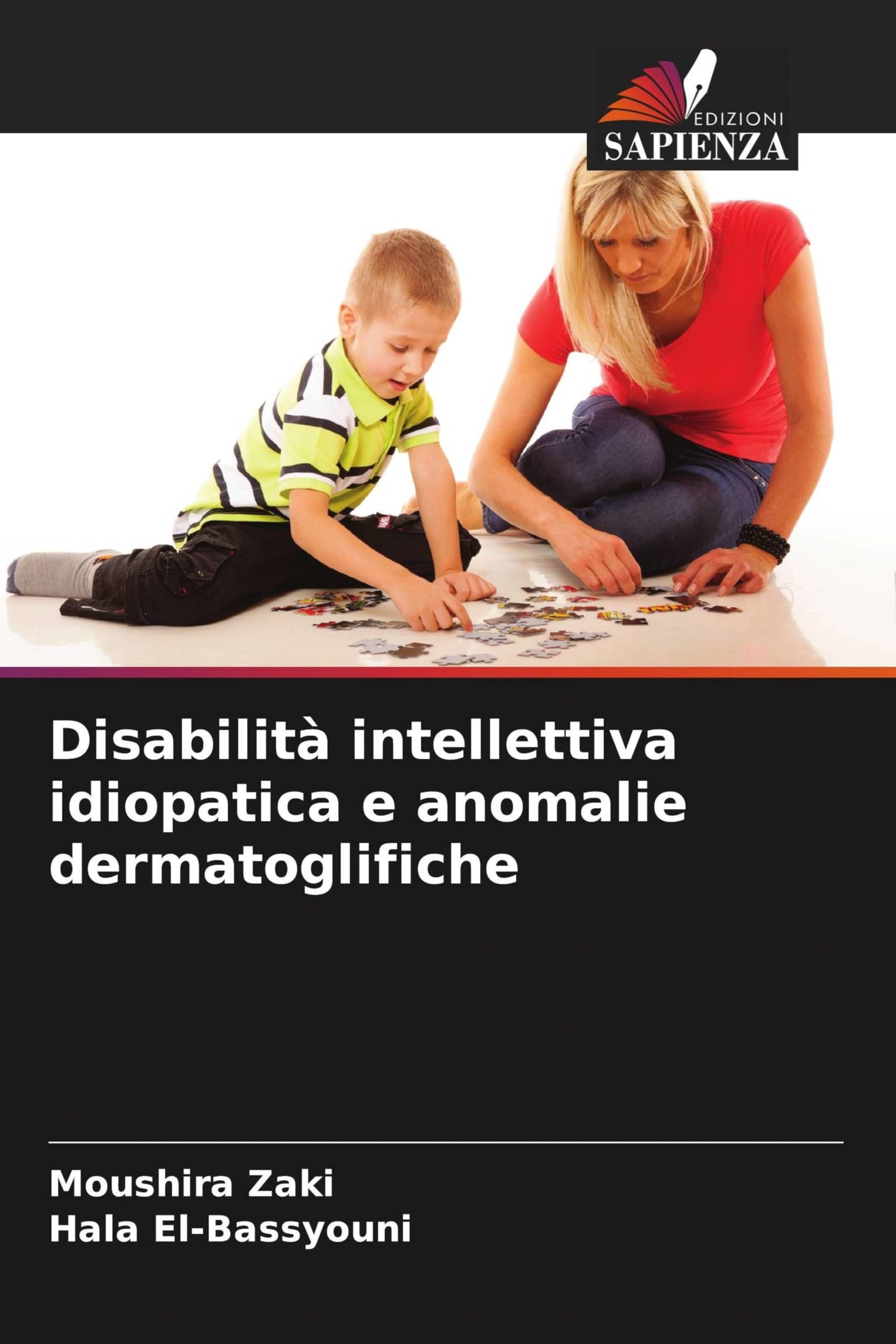 Disabilità intellettiva idiopatica e anomalie dermatoglifiche Medicine