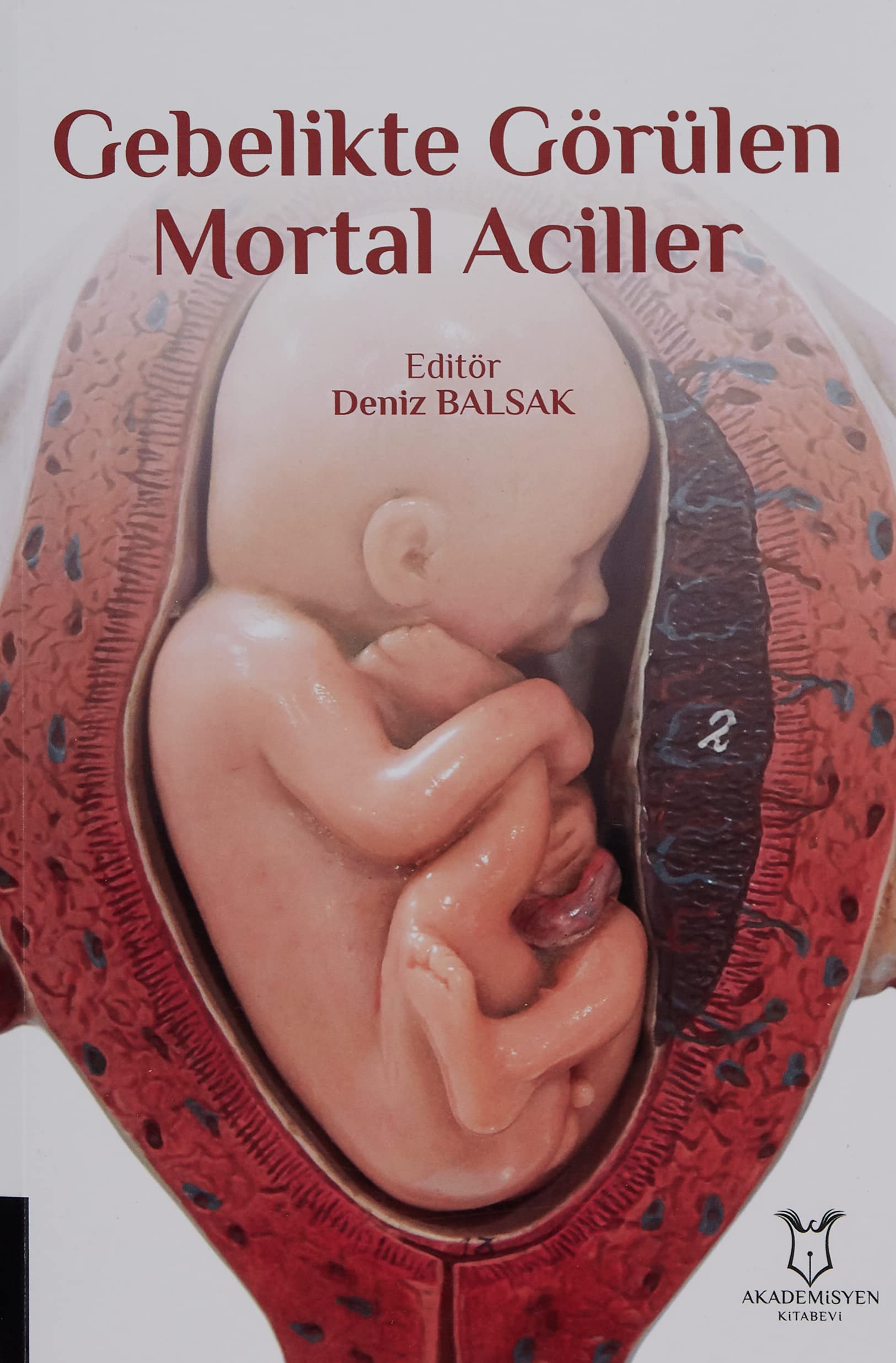 Gebelikte Görülen Mortal Aciller Books