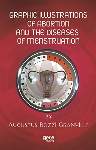 Graphic Illustrations Of Abortion And The Diseases Of Menstruation Books