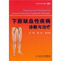 下肢缺血性疾病诊断与治疗(附DVD光盘1张) Books