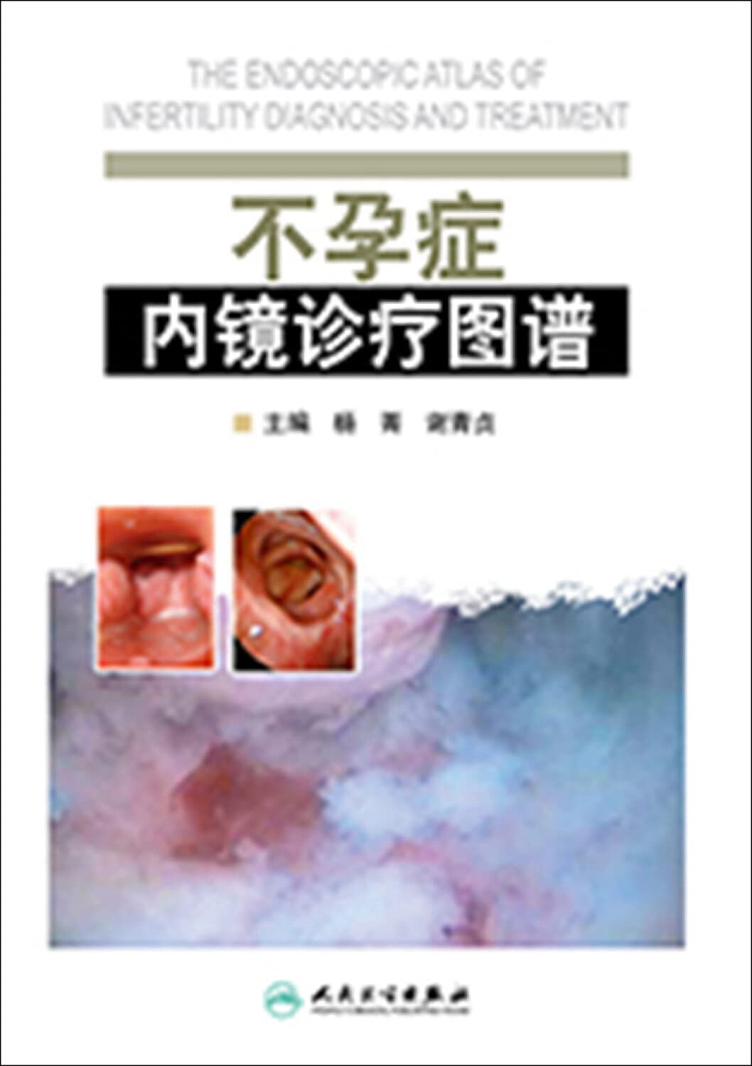 不孕症内镜诊疗图谱 book