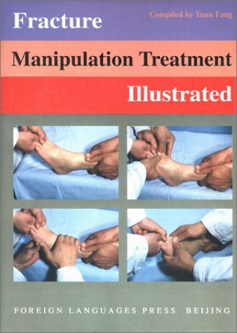 Fracture Manipulation Treatment Illustrated Medicine