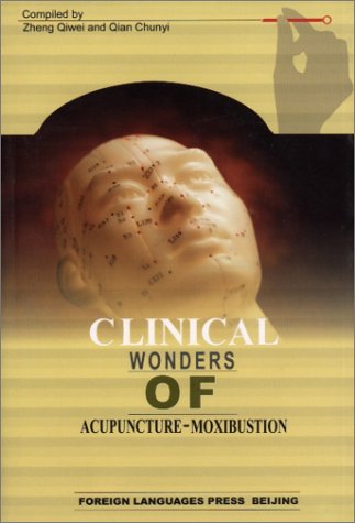 Clinical Wonders of Acupuncture-moxibustion Religion & Esotericism