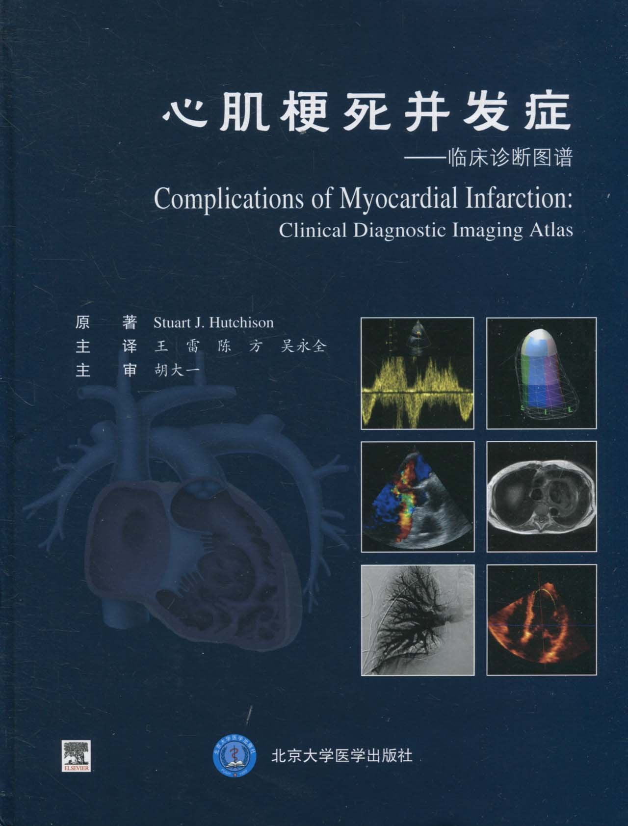 心肌梗死并发症:临床诊断图谱 Books