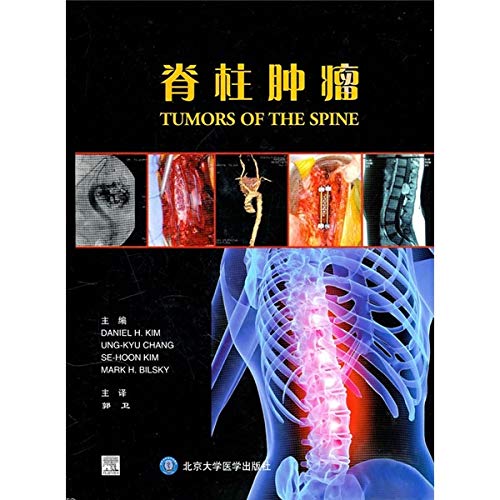 AOSPINE大师丛书全套5册转移性脊柱肿瘤+原发性脊柱肿瘤+颈椎退变性疾病+脊柱畸形+胸腰椎创伤 全套5册 山东科学技术出版社 Books