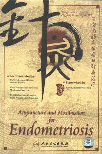 Acupuncture and Moxibustion for Endometriosis Medicine