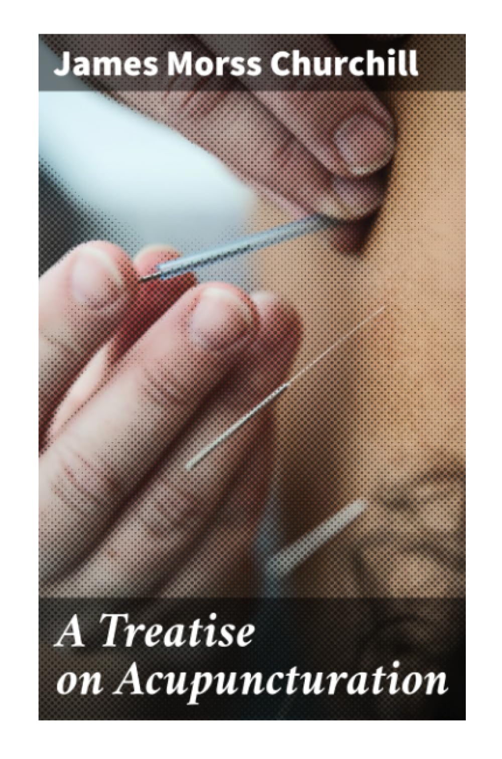 A Treatise on Acupuncturation Health, Nutrition & Fitness