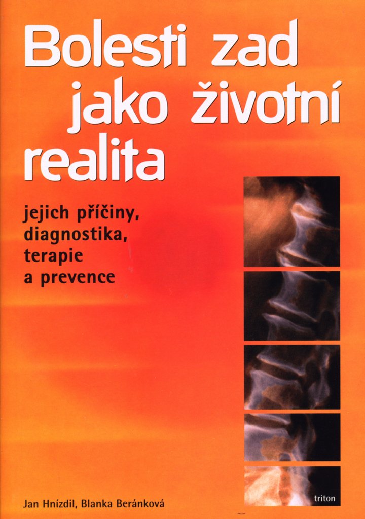 Bolesti zad jako životní realita: jejich příčiny,diagnostika,terapie a prevence (2000) Books