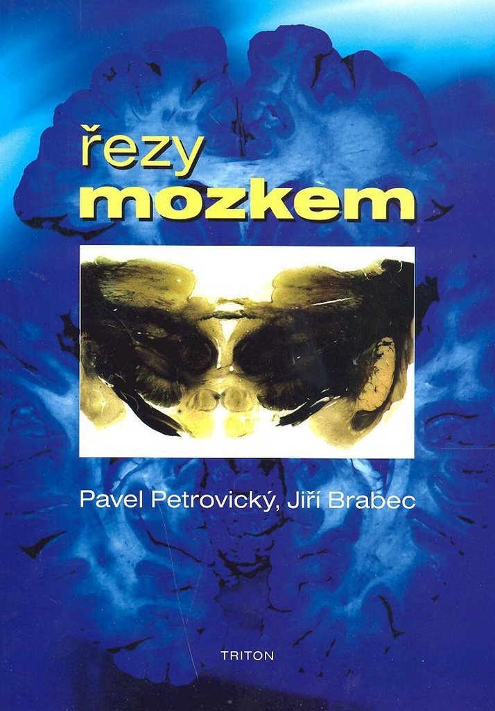 Řezy mozkem: Anatomické, , mikroskopické a magnetické (2007) Books
