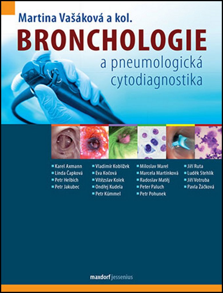 Bronchologie: A pneumologická cytodiagnostika (2017) Books