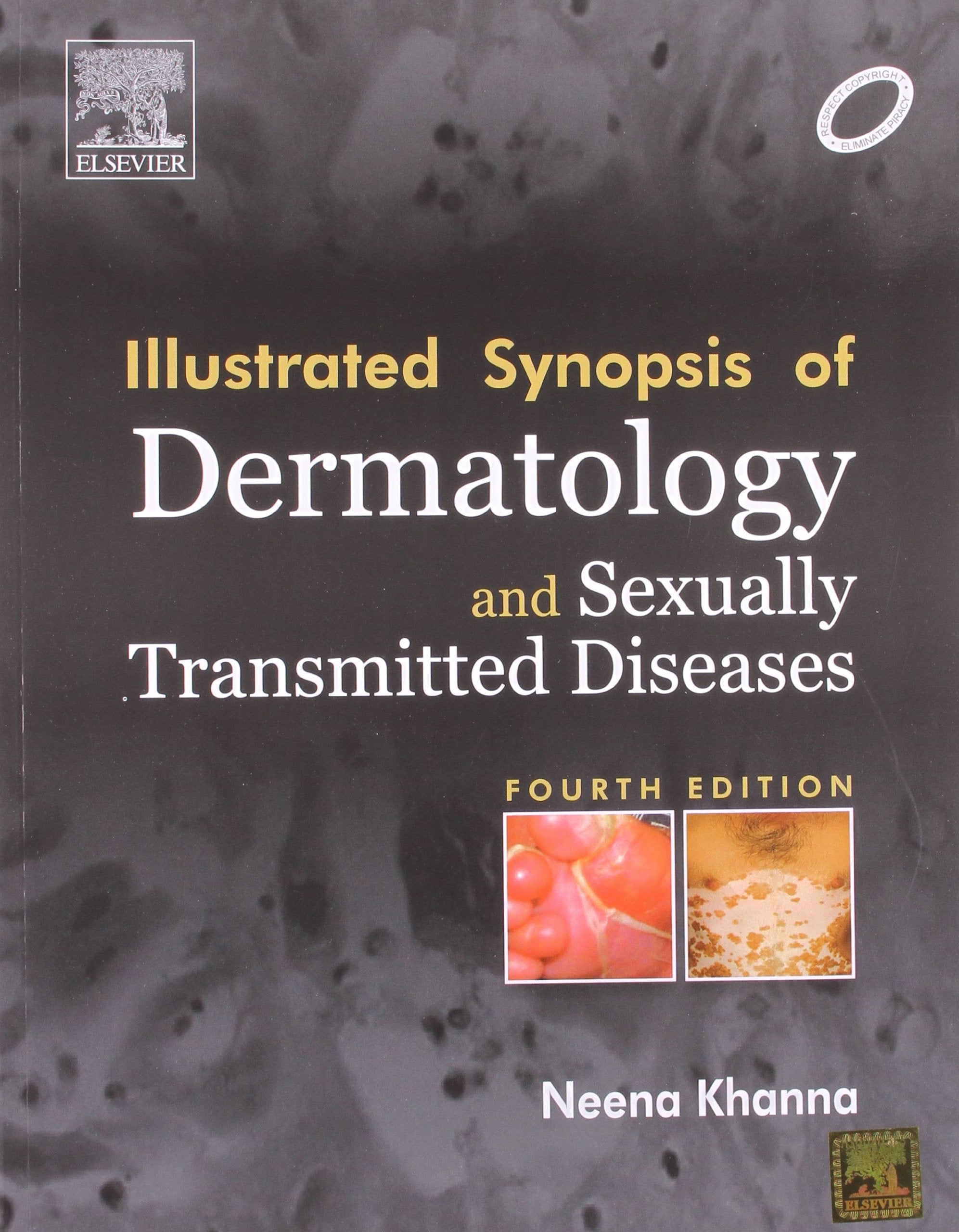 Illustrated Synopsis of Dermatology & Sexually Transmitted Diseases book