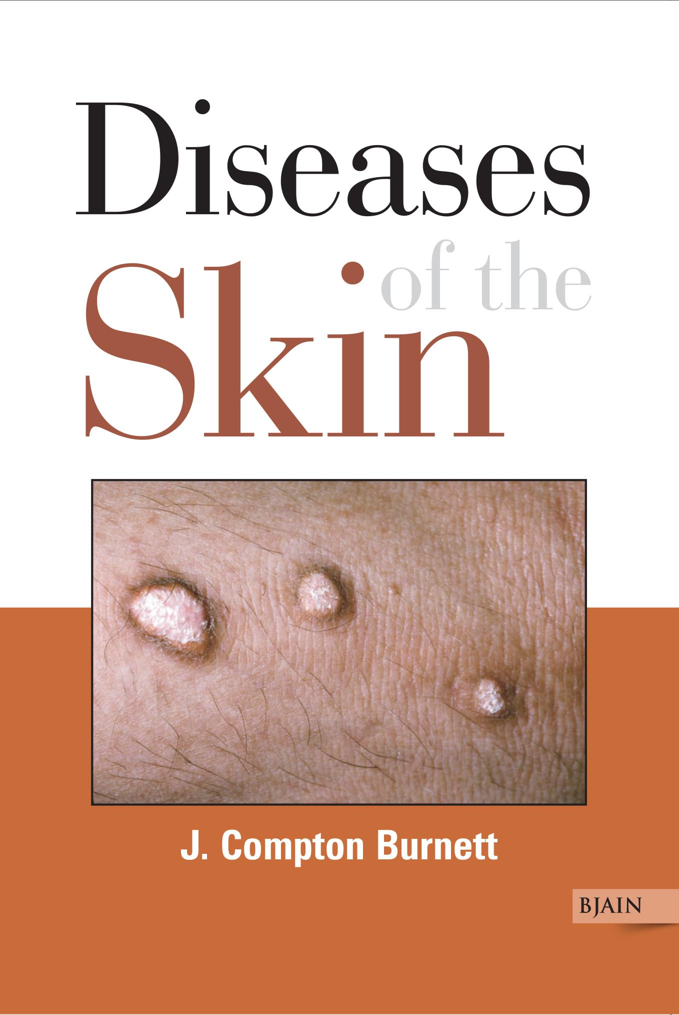 Diseases of the Skin Their Constitutional Nature and Homoeopathic Cure Religion & Esotericism