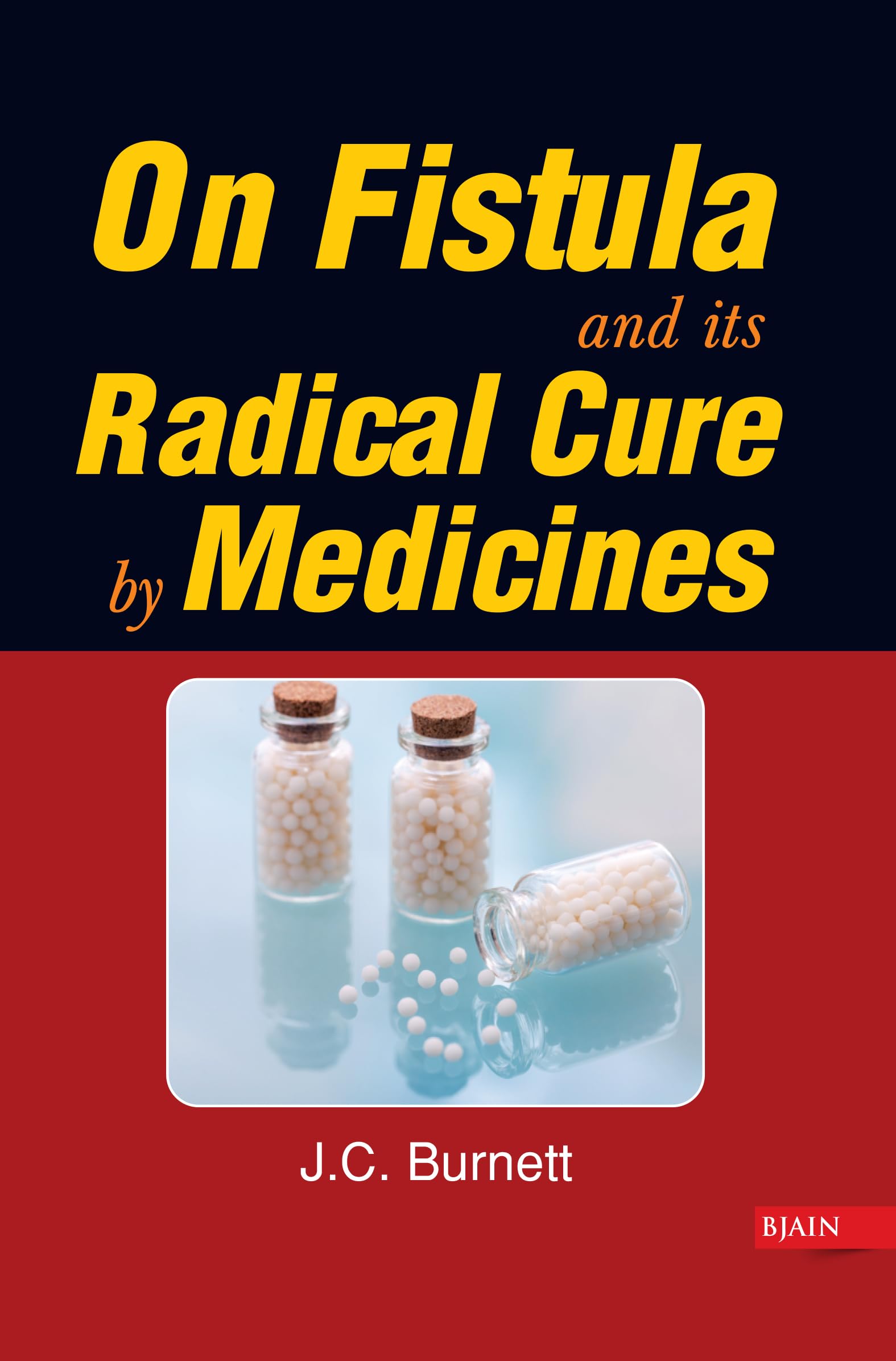 On Fistula & its Radical Cure by Medicines book