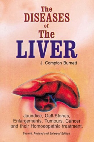 The Diseases of Liver: Jaundice, Gall-stones, Enlargement, Tumours Cancer and Their Homoeopathic Treatment book