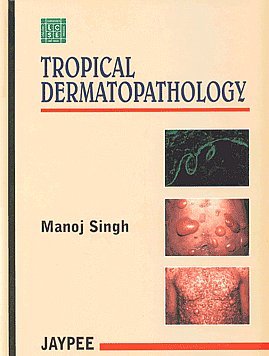 Tropical Dermatopathology Medicine
