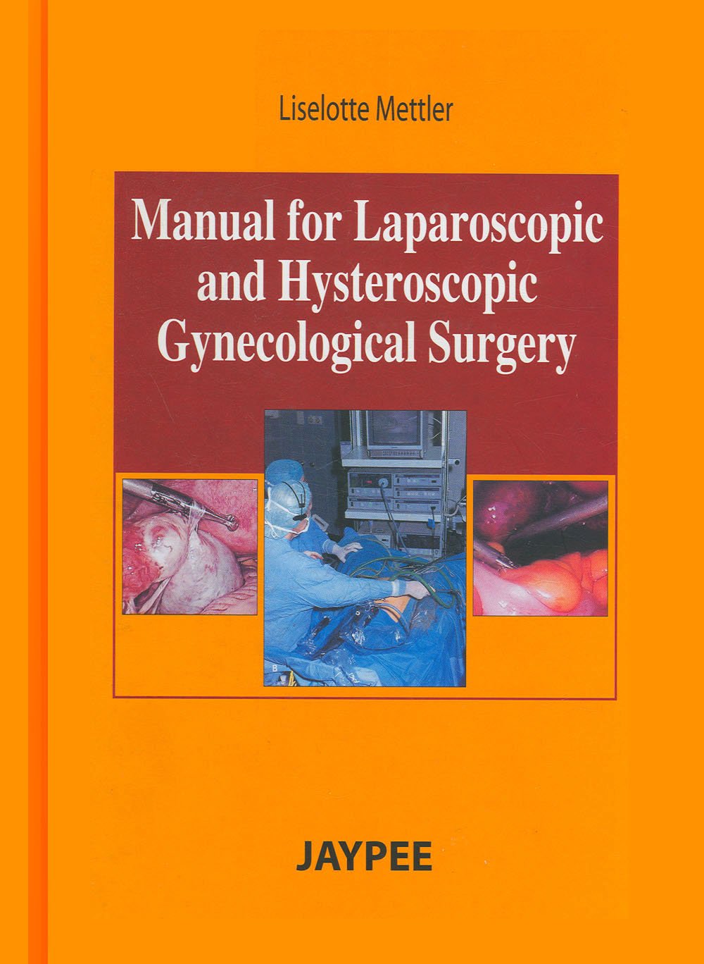 Manual of Laproscopic and Hysteroscopic Gyne.Sur. Medicine