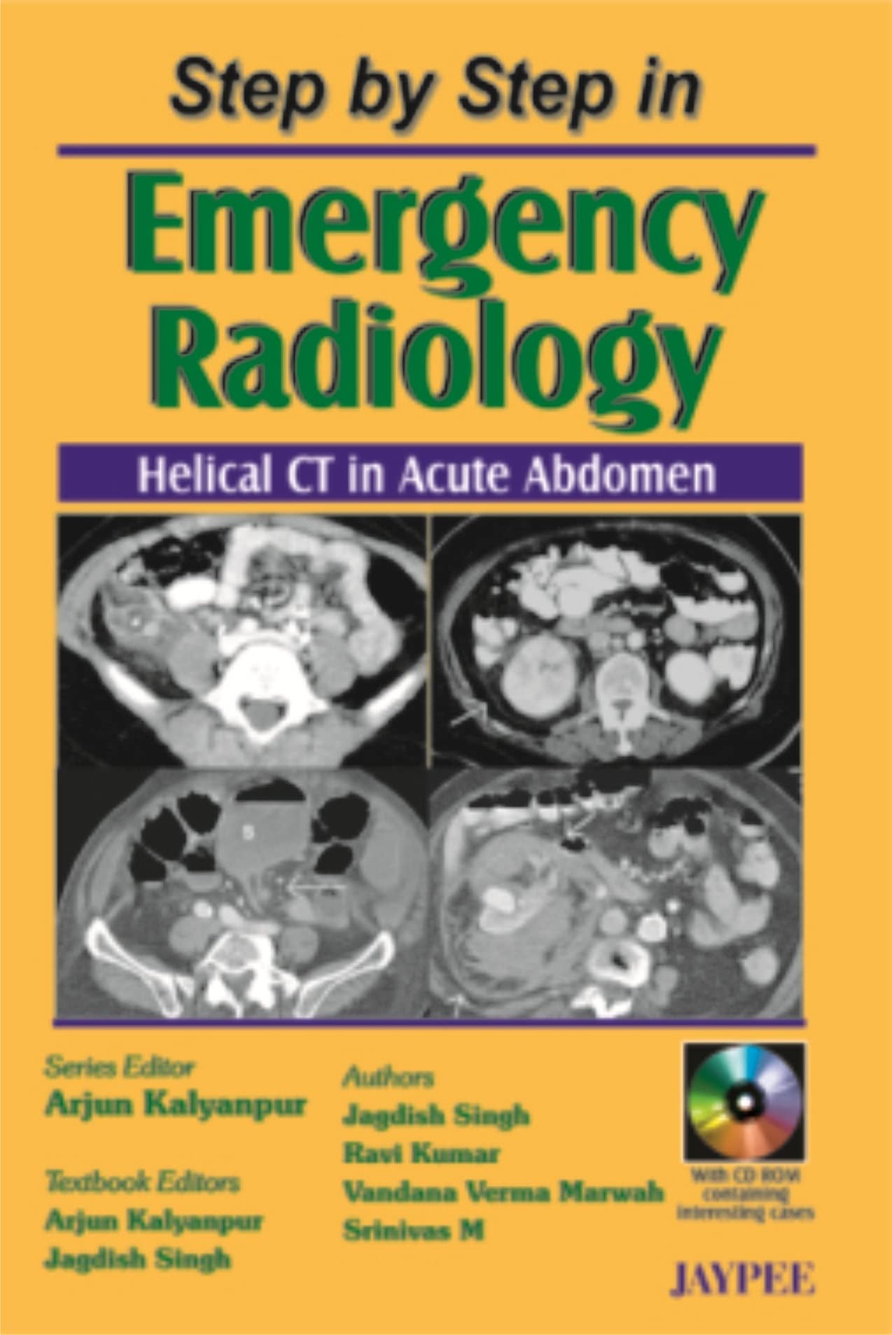 Step by Step in Emergency Radiology: Helical CT in Acute Abdomen Medicine