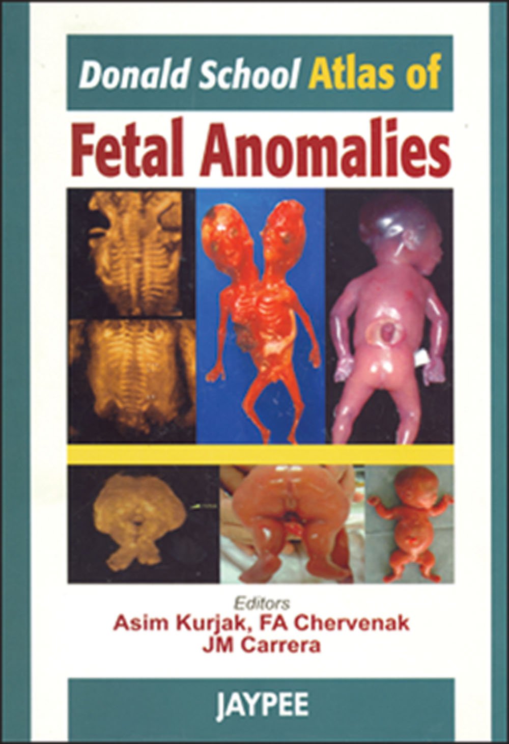 Donald School: Atlas of Fetal Anomalies book
