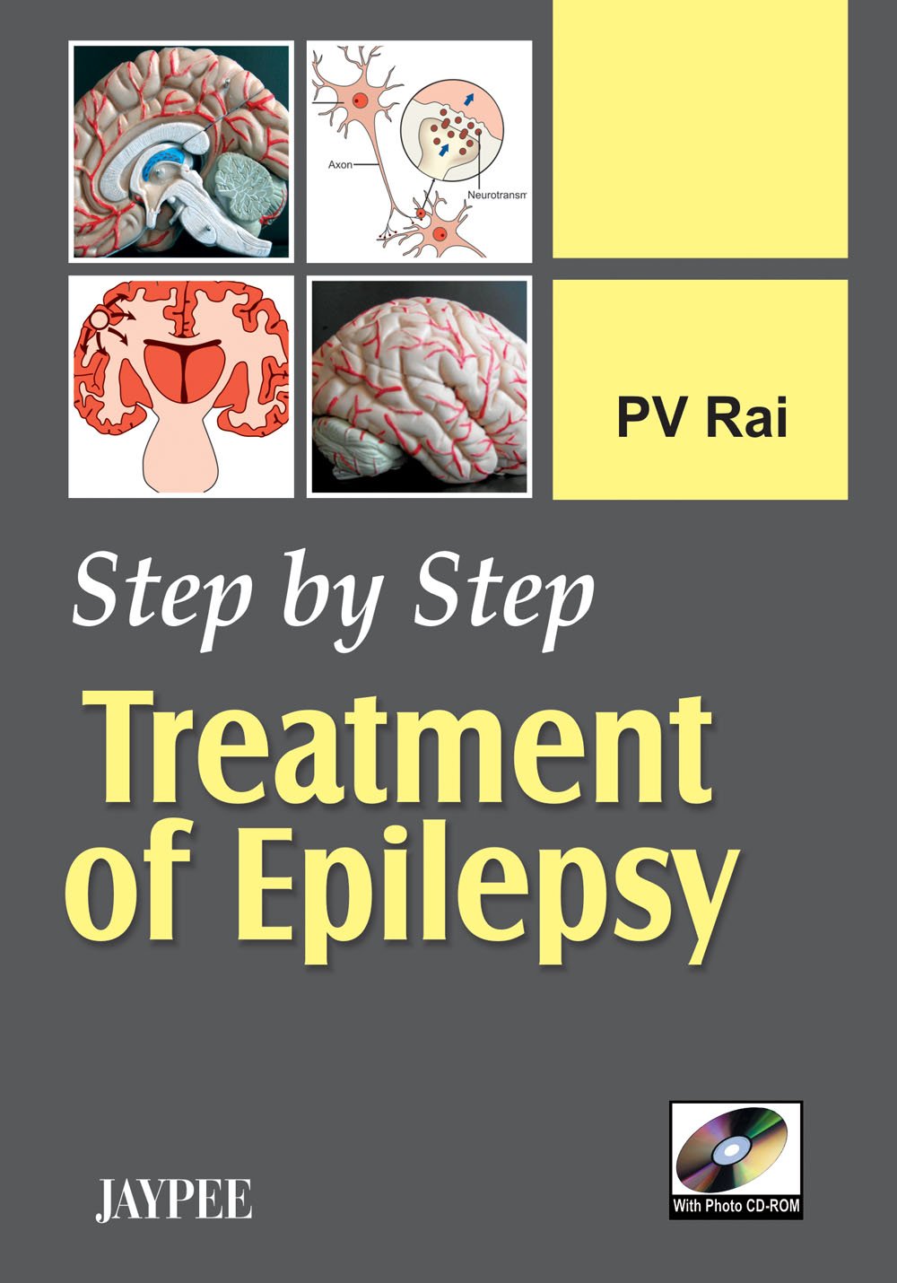 Step by Step Treatment of Epilepsy with Photo CD-Rom Medicine