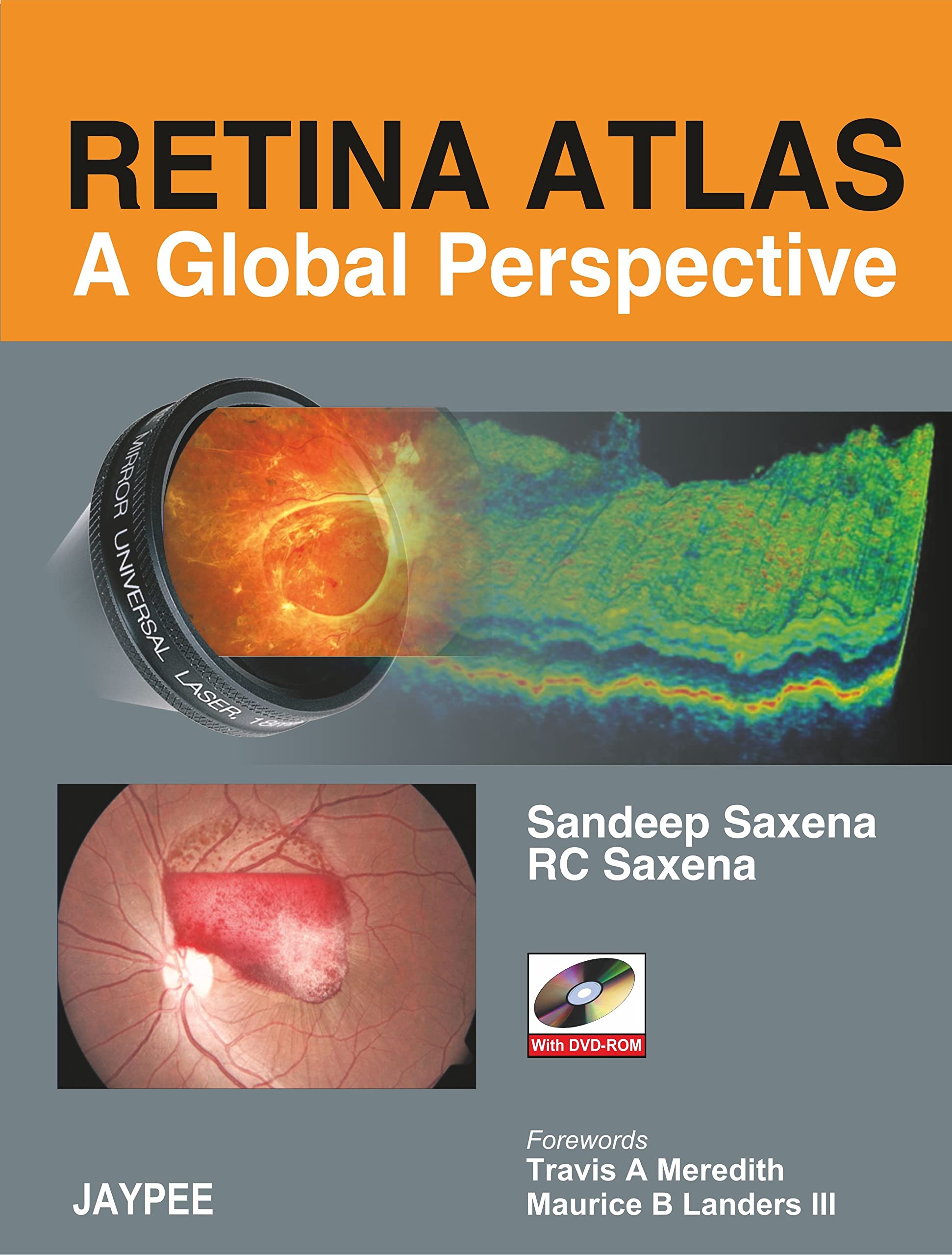Retina Atlas - A Global Perspective Medicine