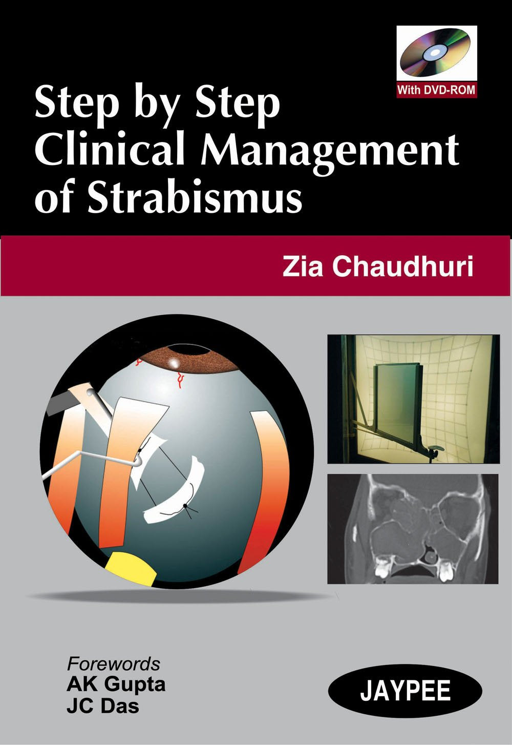 Step by Step Clinical Management of Strabismus book