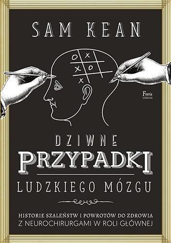 Dziwne przypadki ludzkiego mozgu Medicine