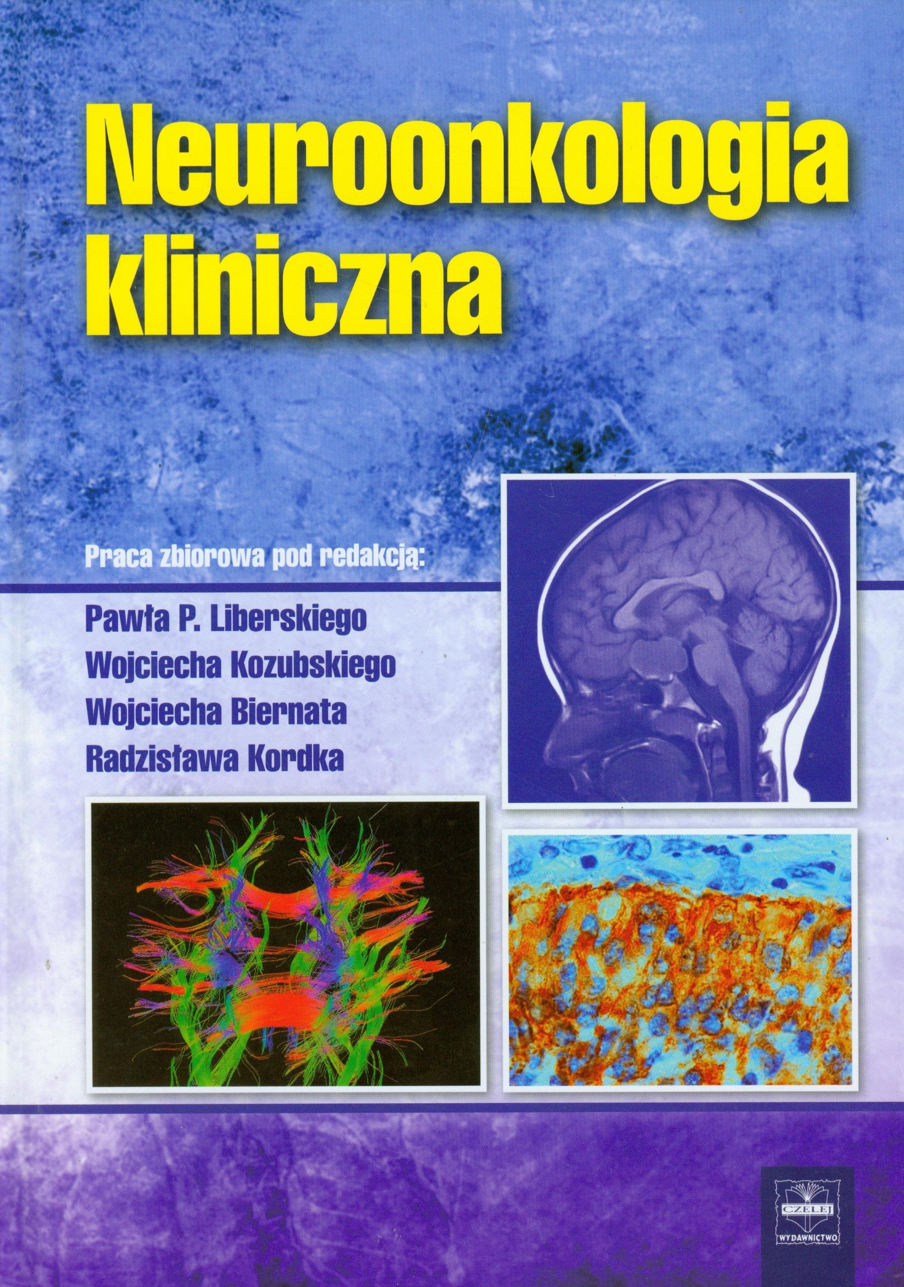 Neuroonkologia kliniczna Medicine
