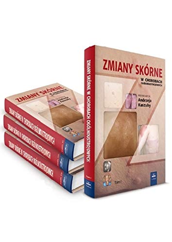 Zmiany skorne w chorobach ogolnoustrojowych Tom 3 (Zmiany skórne w chorobach ogólnoustrojowych Tom 3) Medicine