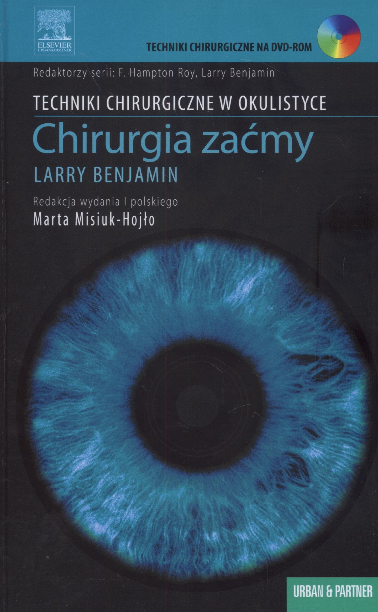 Chirurgia zacmy Techniki Chirurgiczne w Okulistyce Medicine