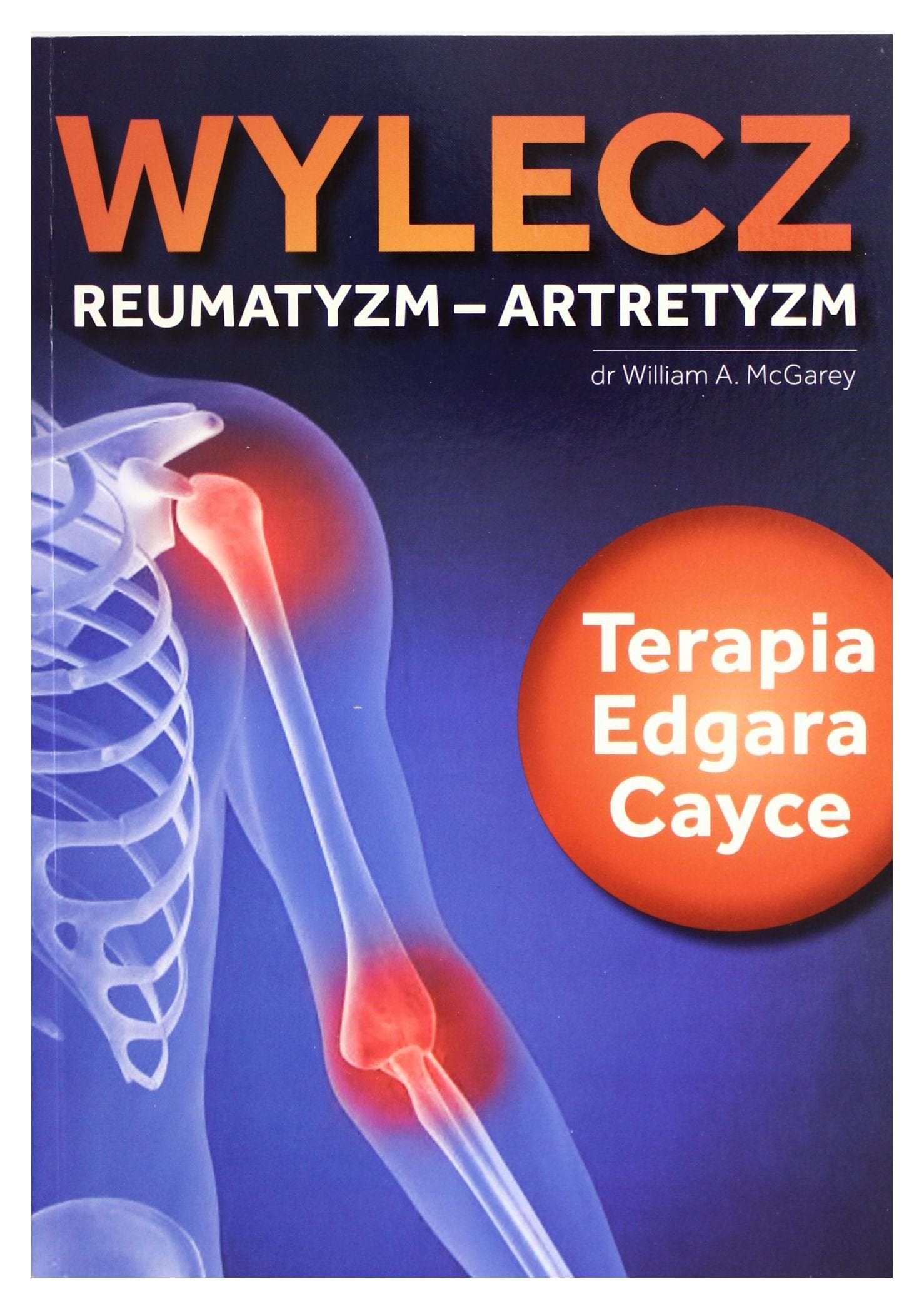 Wylecz reumatyzm-artretyzm: Terapia Edgara Cayce Books