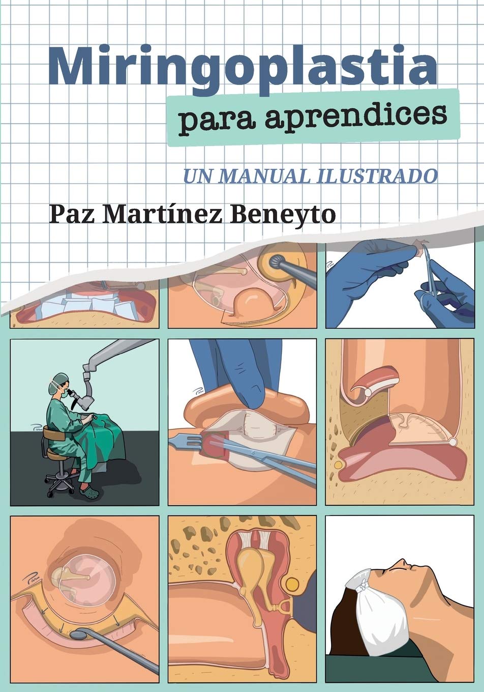 Miringoplastia para aprendices: Un manual ilustrado Medicine