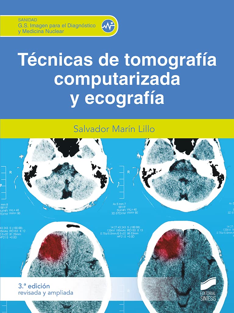 Técnicas de tomografía computerizada (3.ª edición revisada y ampliada) book