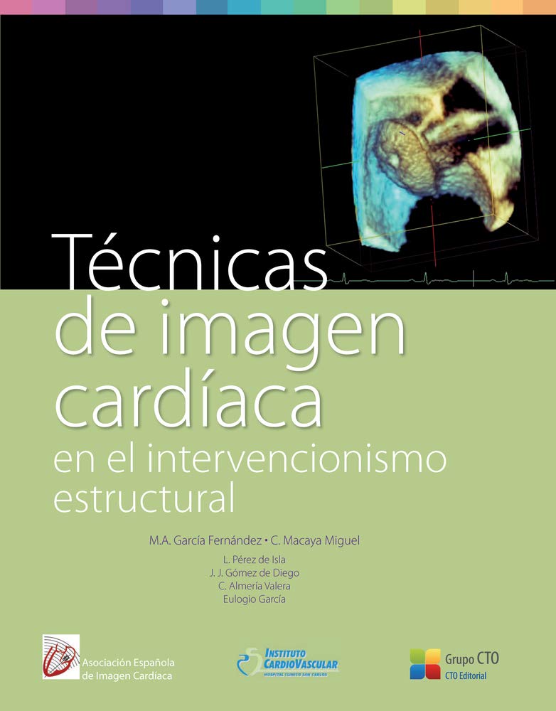 Tecnicas De Imagen Cardiaca/ Cardiac Imaging Techniques book