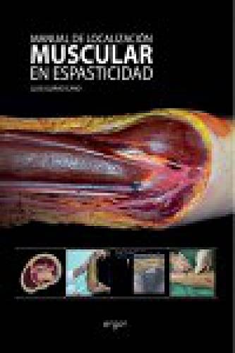 Manual de localización muscular en espasticidad Medicine