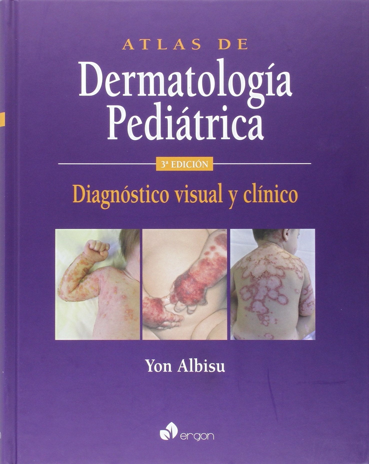 Atlas de Dermatología Pediátrica. 3ª edición: Diagnóstico visual y clínico Medicine