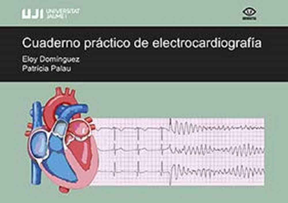 Cuaderno práctico de electrocardiografía. book