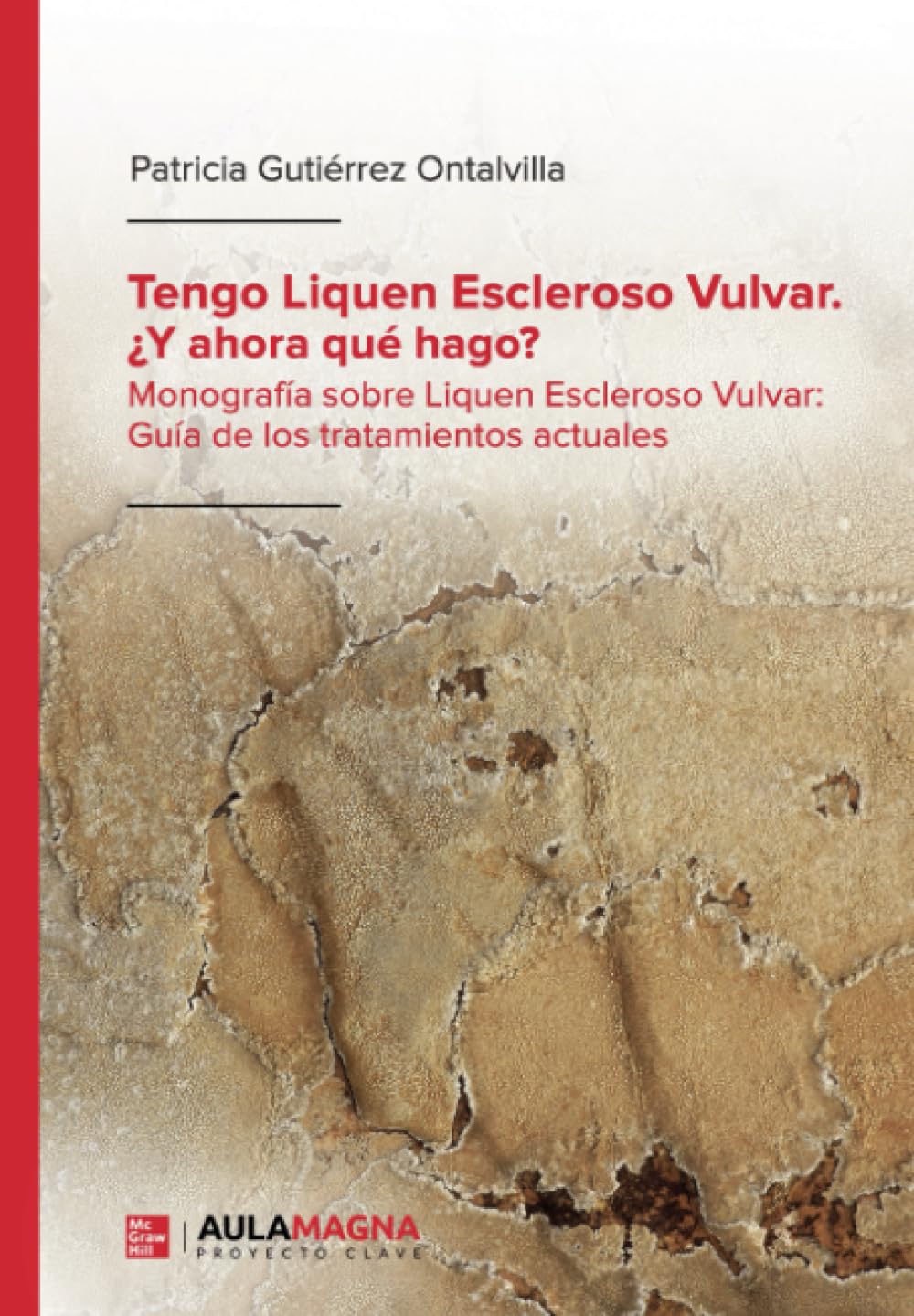 Tengo Liquen Escleroso Vulvar. ¿Y ahora qué hago?: Monografía sobre Liquen Escleroso Vulvar: Guía de los tratamientos actuales Medicine