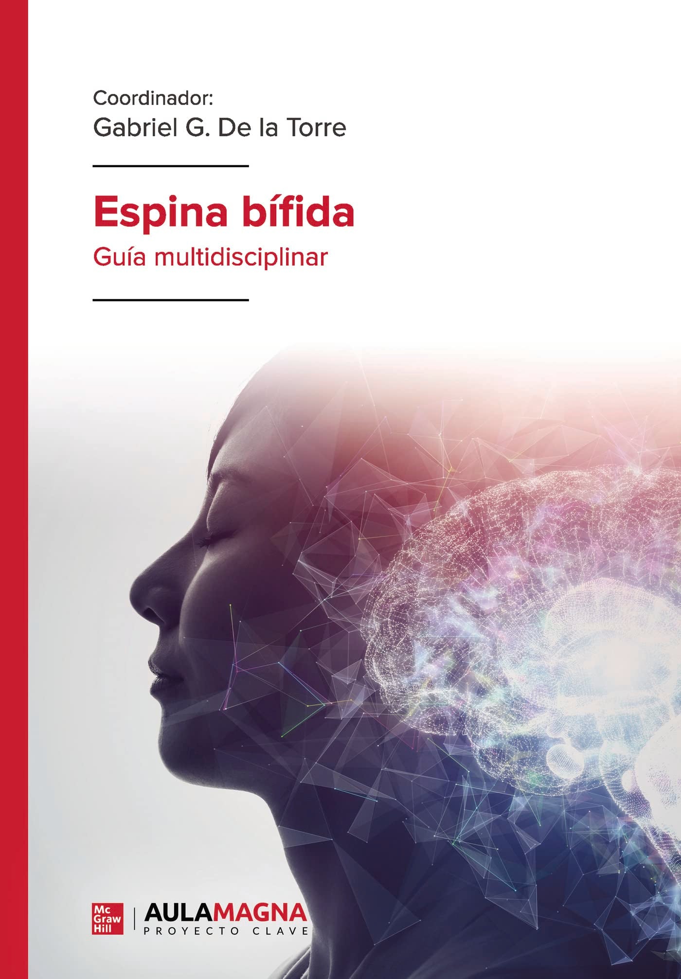 Espina bífida: Guía multidisciplinar Medicine
